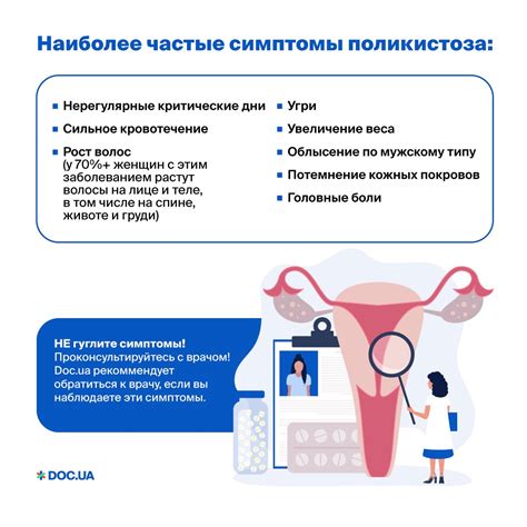  Лечебные методы для повышения вероятности зачатия при поликистозе яичников
