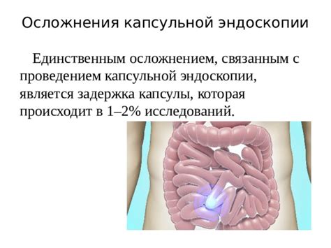  Подготовка к капсульной эндоскопии: рекомендации и ограничения 