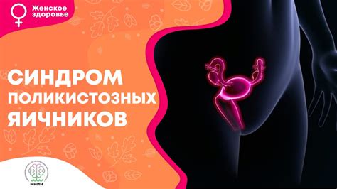  Положительное воздействие стимуляции яичников на женское здоровье 