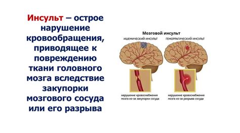  Применение шкалы Ренкина в диагностике острого нарушения мозгового кровообращения (ОНМК)