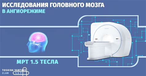  Работа функциональной магнитно-резонансной томографии: расшифровка активности головного органа 