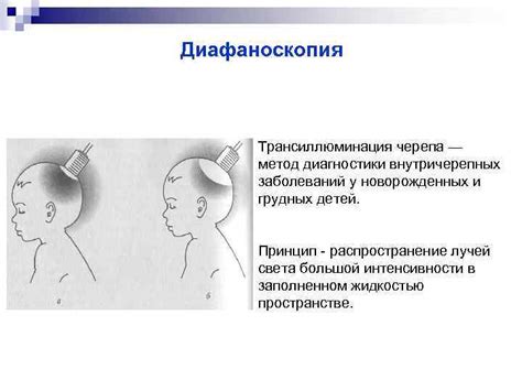  Распространенные основания проведения рентгеновской диагностики головы у грудных детей 