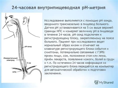  Ход выполнения процедуры измерения давления в пищеводе: от подготовки к получению результатов 