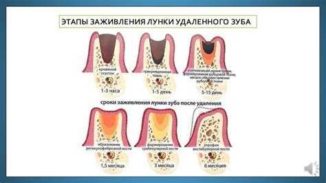  Этапы удаления задней панели
