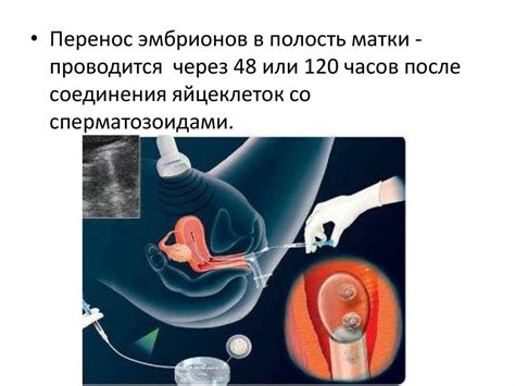 Альтернативы при отсутствии маточных труб
