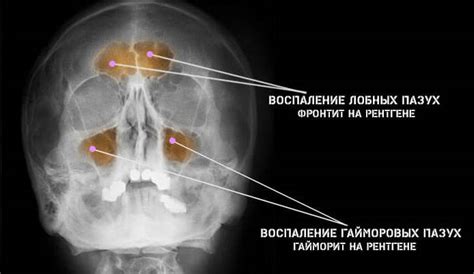 Альтернативы рентгену