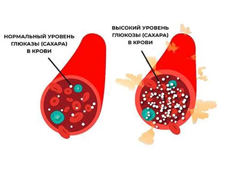 Антиоксиданты в миндалях и их влияние на сахарный диабет