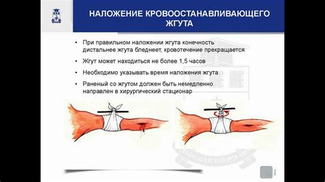 Важность кровоостанавливающего жгута на тесте