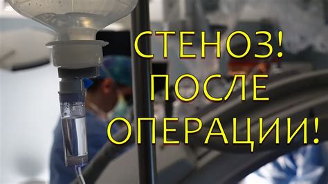 Важные факторы, влияющие на сроки возвращения на работу после операции на руку
