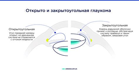 Валосердин: действие на глаукому