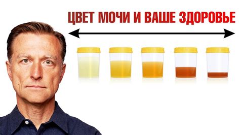 Влияние антибиотиков на цвет мочи