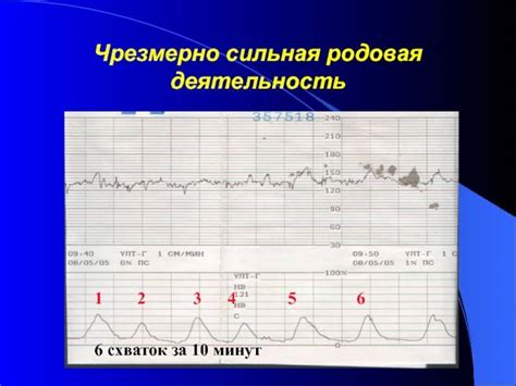 Влияние движения на схватки