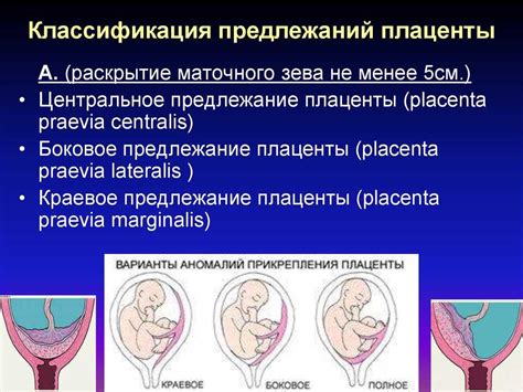 Влияние низкой плацентации на первоначальную фазу родов