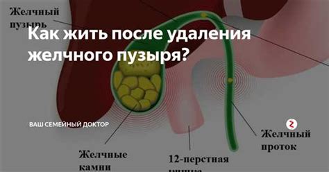 Влияние отсутствия желчного пузыря на организм