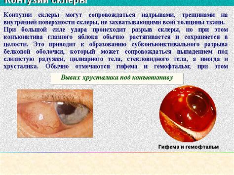 Возможность повреждения глаз и лица от отдачи