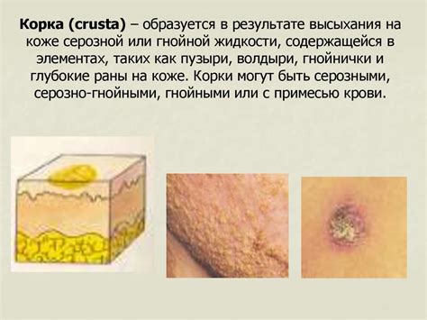 Вредности засохшей жидкости на коже