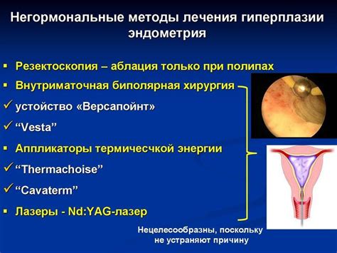 Диагностика гиперплазии эндометрия