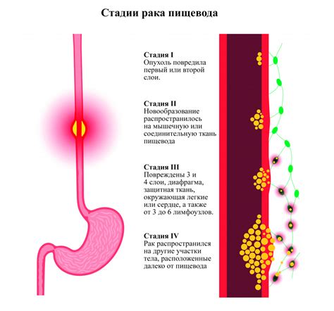 Диагностика обжигания пищевода горячим чаем