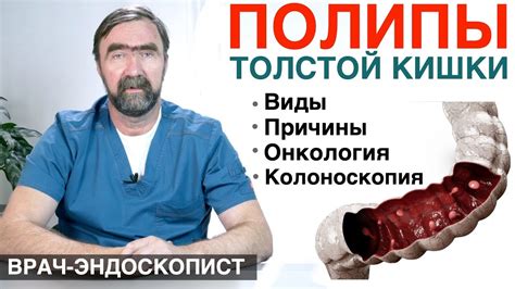 Диагностика полипов в толстой кишке