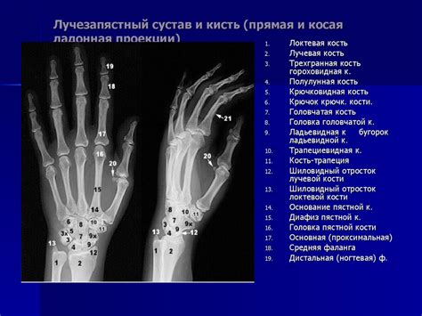 Изменение положения суставов и конечностей
