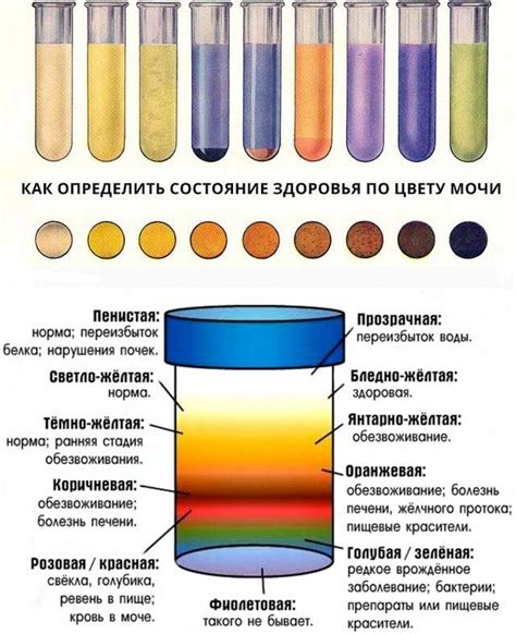 Какие антибиотики могут вызывать изменение цвета мочи