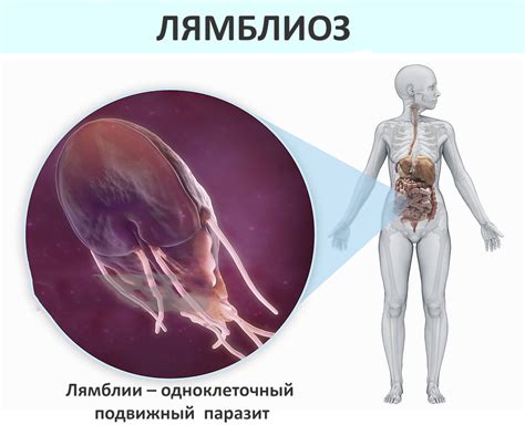 Какие симптомы может вызвать лямблиоз у человека?