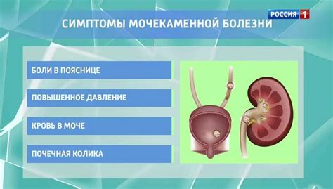 Какое лечение применяется?