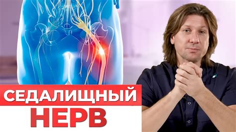 Как возникает отек при защемлении седалищного нерва