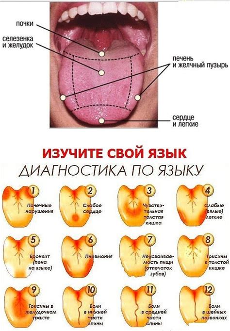 Как диагностировать стоматит на языке