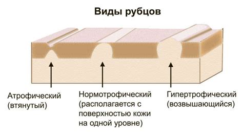 Как избежать образования рубцов