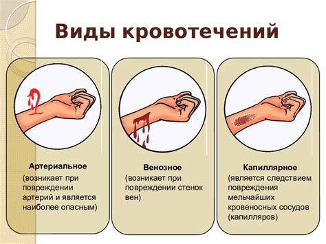 Как определить, что кровотечение связано с миомой?