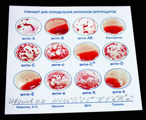 Как определить возможное количество сдаваемой крови?