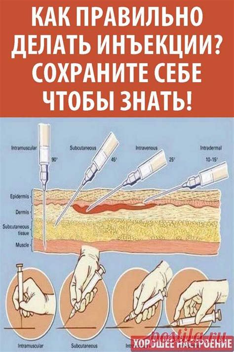 Как правильно делать инъекции ребенку?