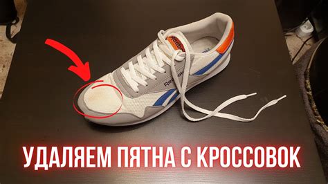 Как удалить пятна и загрязнения с белых кроссовок?