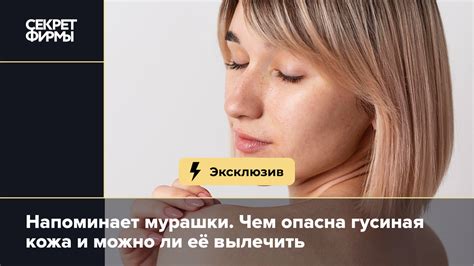 Как устранить гусиную шею: эффективные приемы и тренировки