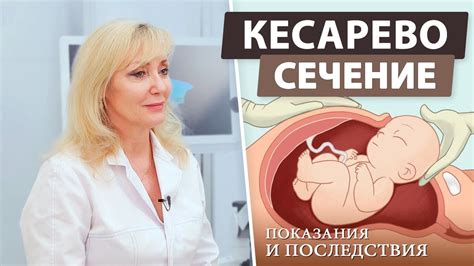 Когда действительно необходимо кесарево?