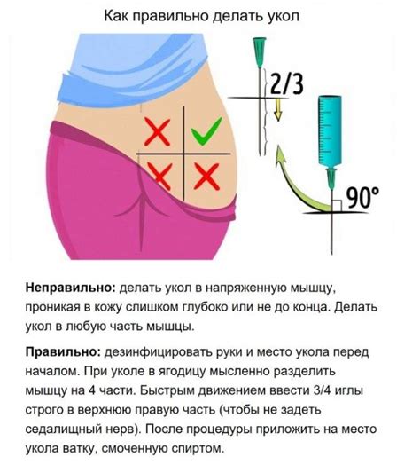 Колоть ли глиатилин в ягодицу?