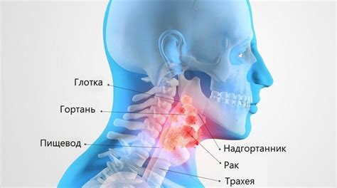 Костная попадание в горло: причины и симптомы