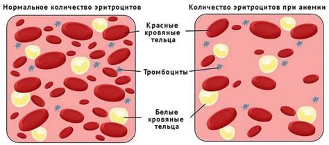 Лечение повышенной температуры при пониженном гемоглобине