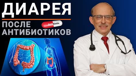 Лечение поноса при ПМС