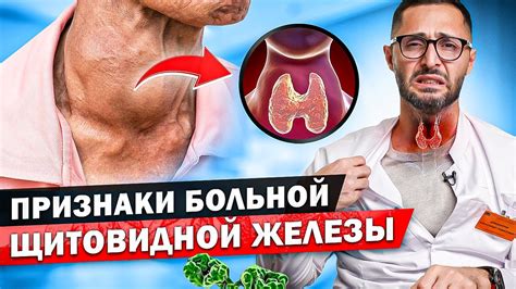 Лютая беда: последствия и способы профилактики