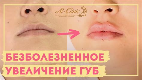Массаж для увеличения объема губ за 1 минуту