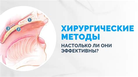 Медицинские методы лечения храпа