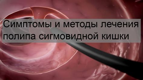 Методы лечения полипа у ребенка