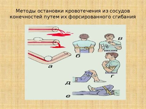 Методы предотвращения и лечения кровотечения