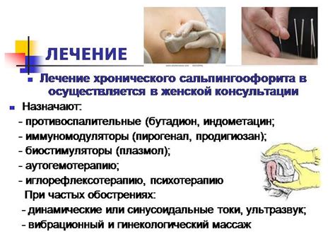 Метод 1: Лечение антибиотиками
