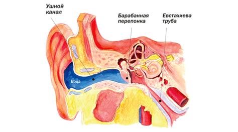 Механизмы проникновения воды в ухо