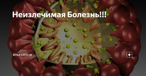 Миф 2: Сифилис - неизлечимая болезнь