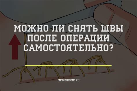 Можно ли самостоятельно удалять швы?