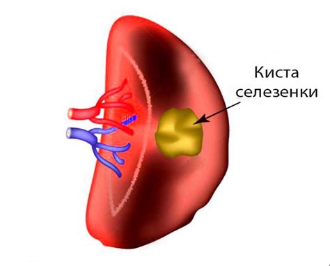 Наследственность и наличие двух селезенок у человека